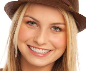 orthodontics for teens uwanee ga