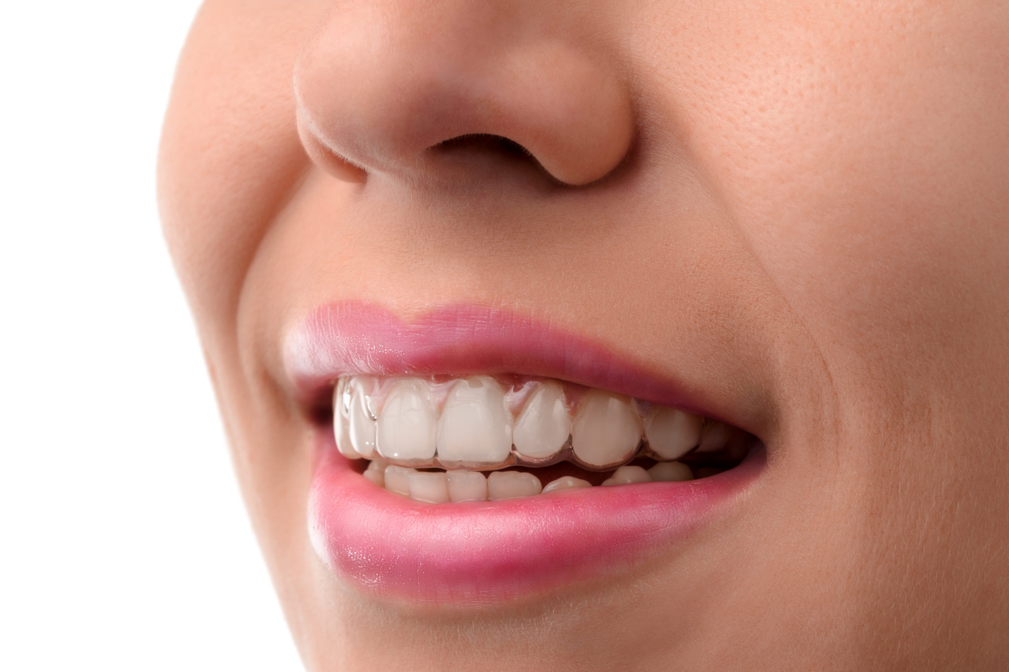 Can invisalign break your teeth