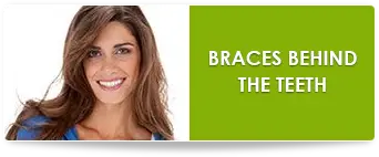 Braces behind teeth