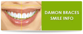 Damon braces in suwanee ga