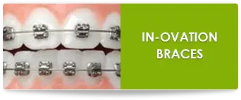 In ovation braces in suwanee ga