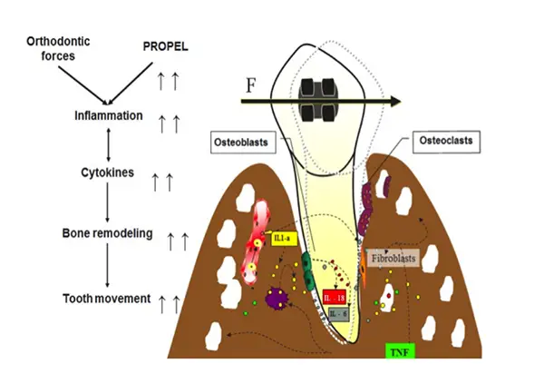 Propel orthodontist duluth ga